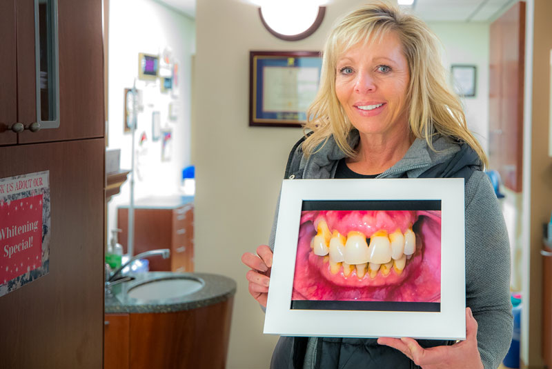 dental implants patient smiling