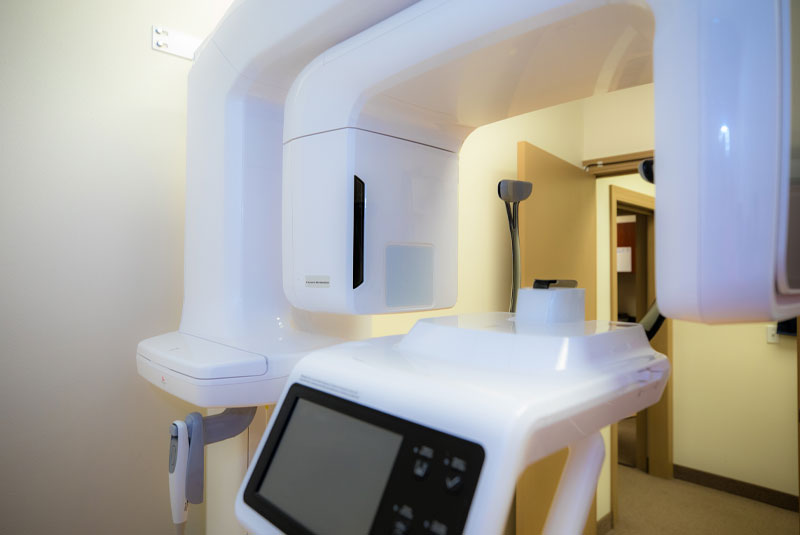 dental cbct scanner