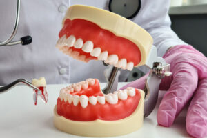 a full mouth model showcasing a single tooth extraction.