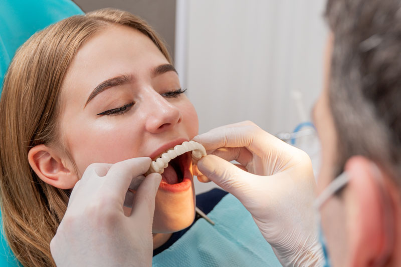 a dental patient getting her final prosthesis placed by her trusted doctor in her All-On-X dental implant procedure.