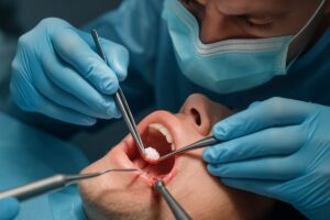 Image of a dentist placing bone grafting material into a patient's jaw, preparing it for a dental implant. The dentist is wearing surgical gloves and a mask, with dental instruments visible. No text on image.